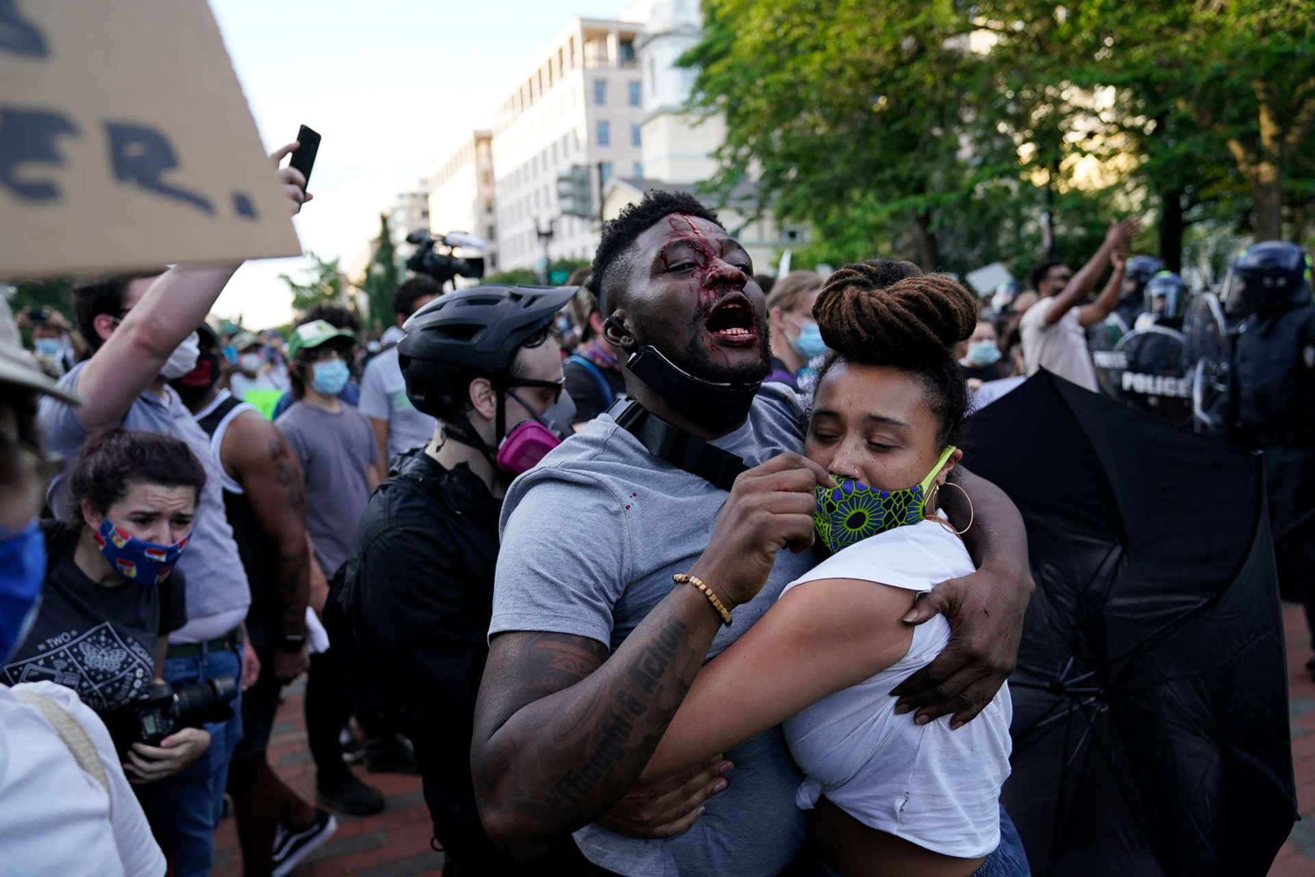 An injured protester being comforted in the street